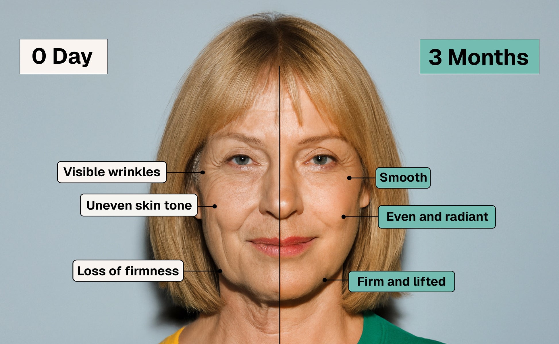 Micro Infusion System for Anti-ageing